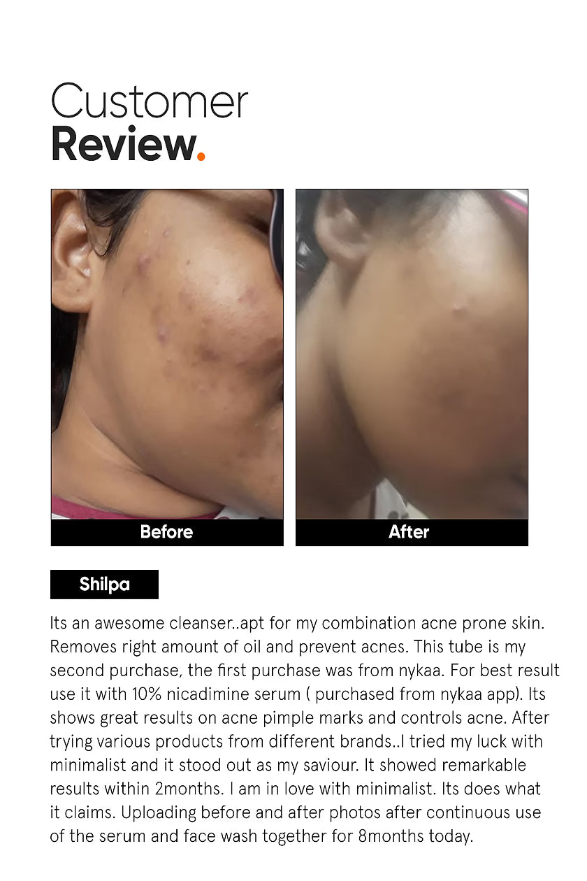 Salicylic Acid 2% Face Serum